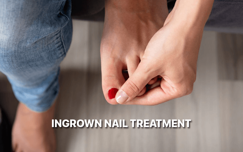 Ingrown Nail Treatment
