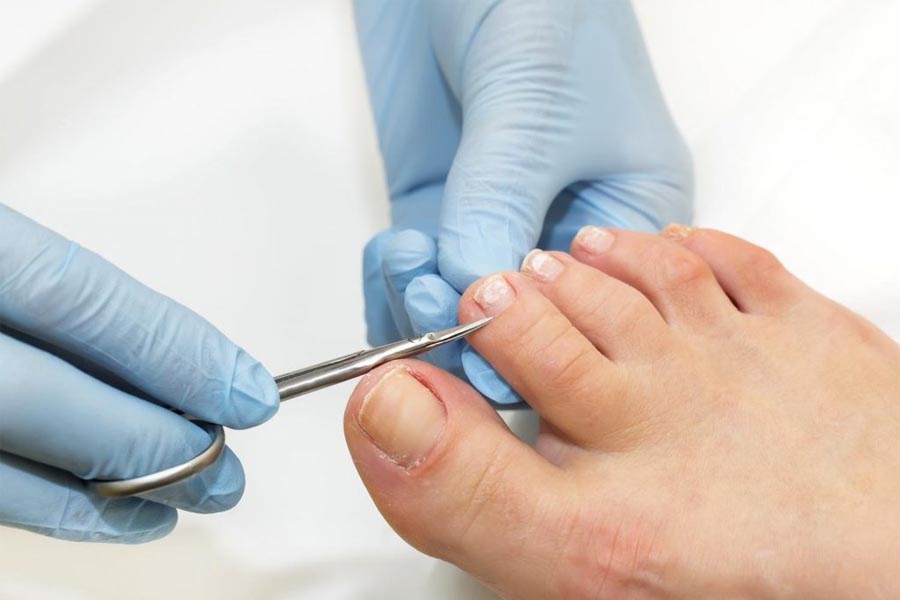 Toenail Troubles –The Common Toenail Issues and their Solutions